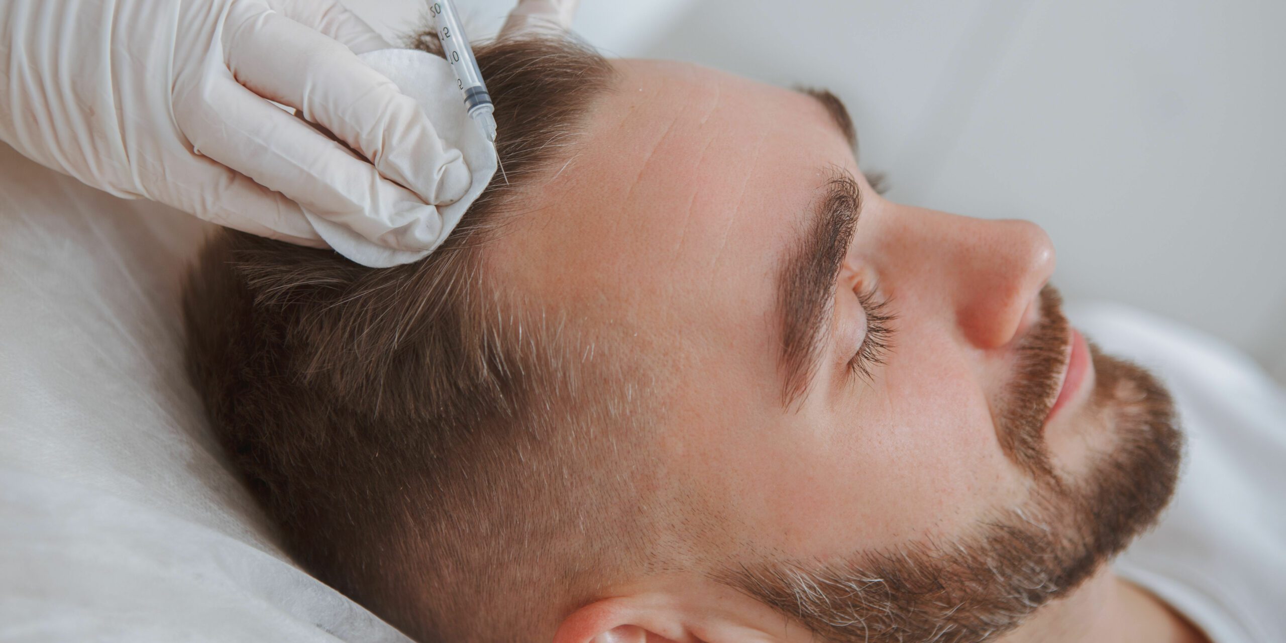 Man getting PRP for hair loss